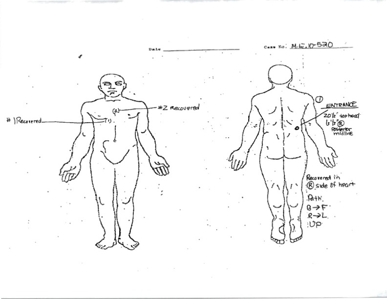 Mendez autopsy
